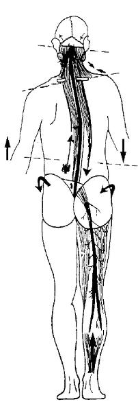 Illustration of the human body showing torque patterns and postural imbalance caused by spinal subluxations — representing how Torque Release Technique addresses structural distortion at The Wellness Path in Knoxville TN